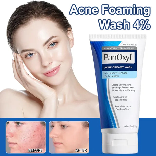 PanOxyl® Acne Creamy Wash Benzoyl Peroxide  4% 156g - Classy Touch Pk